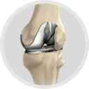 Primary Hip & Knee Replacement